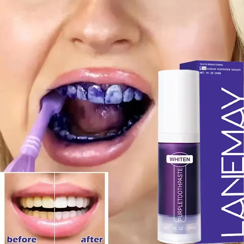 Teeth Whitening Crest - V34 สีม่วงฟันไวท์เทนนิ่งยาสีฟันลบคราบจุลินทรีย์ทําความสะอาดสุขอนามัยช่องปากทันตกรรม Bleach เครื่องมือ Fresh Breath