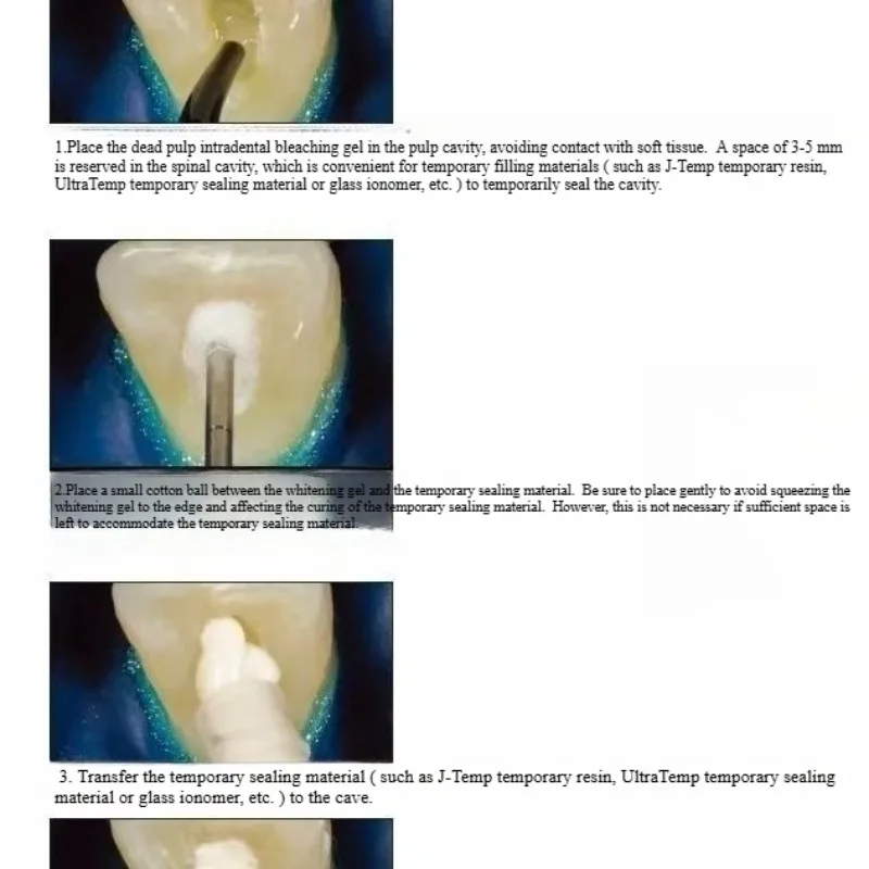 วัสดุฟื้นฟูช่องปากและฟัน ยาฟอก - Teeth Whitening Effects บทวิจารณ์และราคา