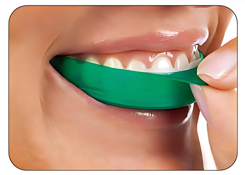 แผ่นฟอกสีฟันอัลตร้าเดนท์ โอพาเ - Teeth Whitening Opalescence Go บทวิจารณ์และราคา