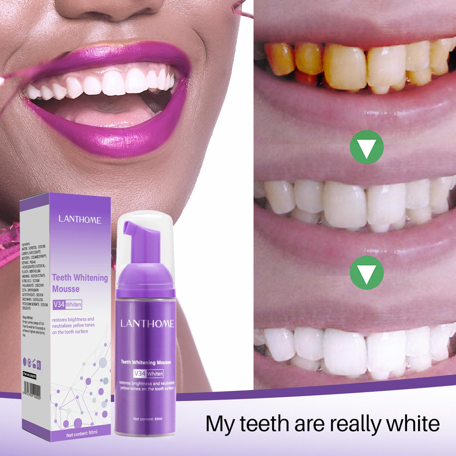 50MLTeeth Whitening Mousse ลบค - Teeth Whitening Foam Toothpaste บทวิจารณ์และราคา