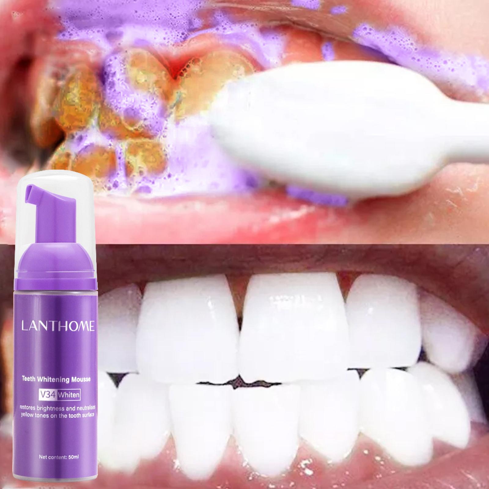 50MLTeeth Whitening Mousse ลบค - Teeth Whitening Foam Toothpaste บทวิจารณ์และราคา