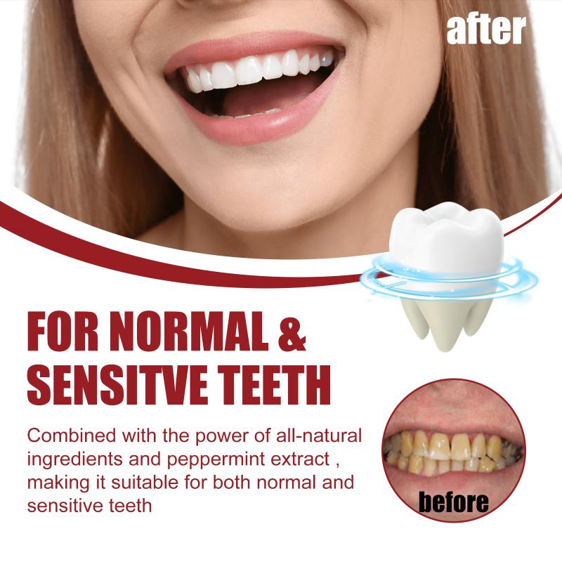 ยาสีฟันโปรไบโอติก SP-5 ยาสีฟัน - Teeth Whitening Foam Toothpaste บทวิจารณ์และราคา
