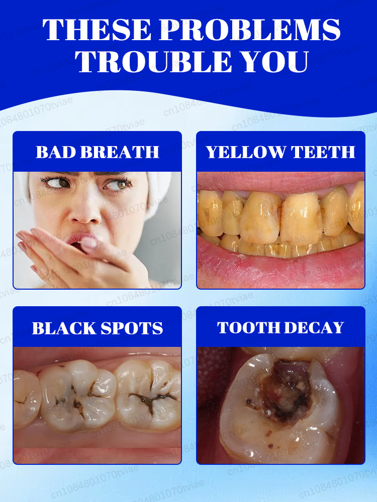 ยาสีฟันไวท์เทนนิ่งและผงแร่ธาตุ - Teeth Whitening Effects บทวิจารณ์และราคา