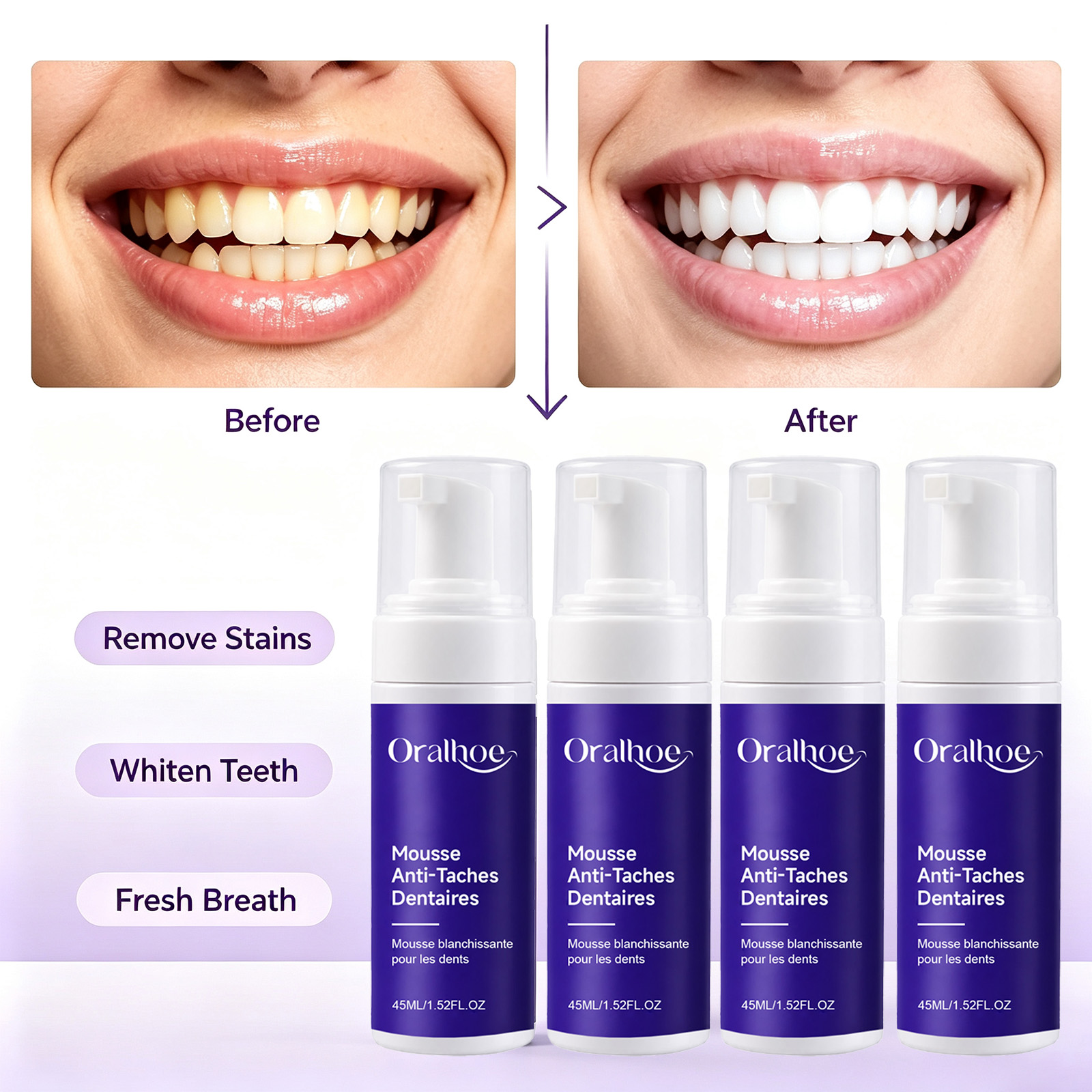 ยาสีฟันฟอกสีฟันสีม่วง โฟมไวท์เ - Teeth Whitening Routine บทวิจารณ์และราคา