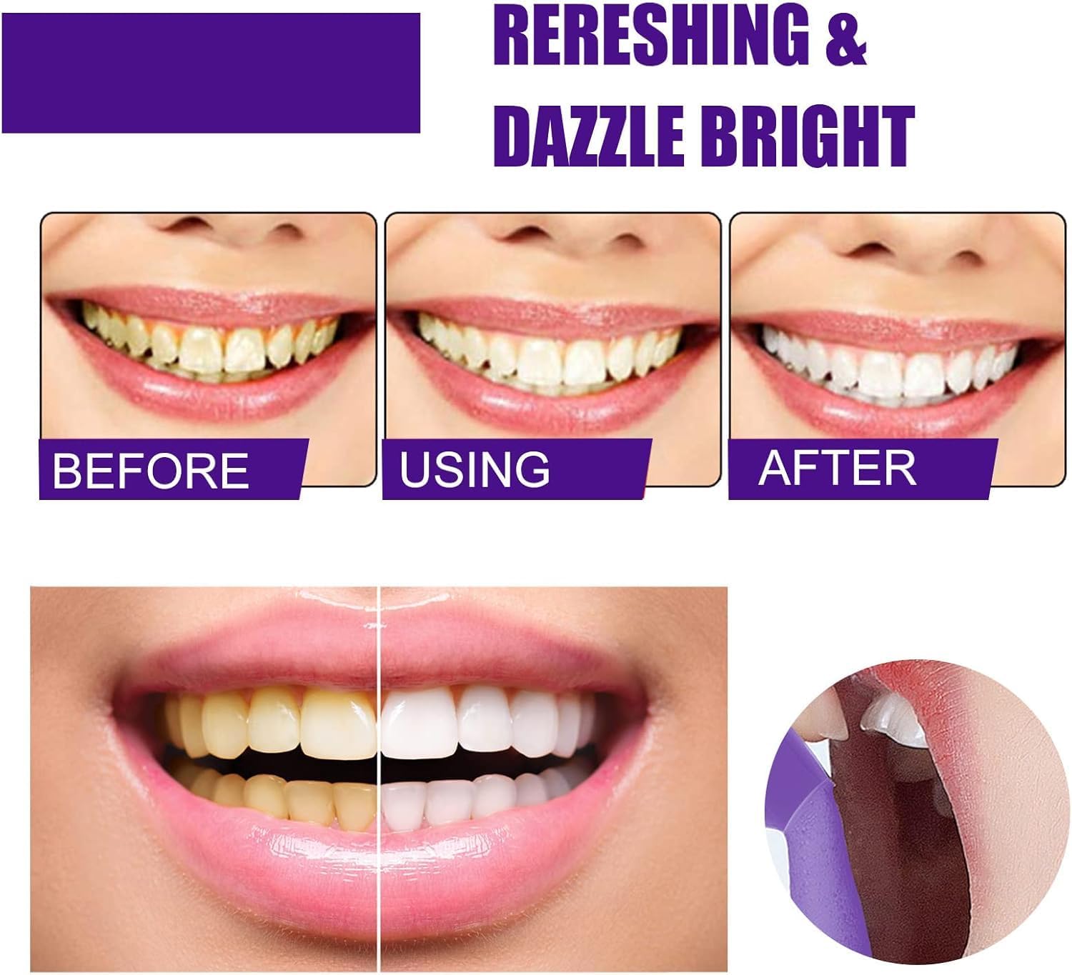 ยาสีฟันฟอกสีฟันสีม่วง โฟมไวท์เ - Teeth Whitening Routine บทวิจารณ์และราคา