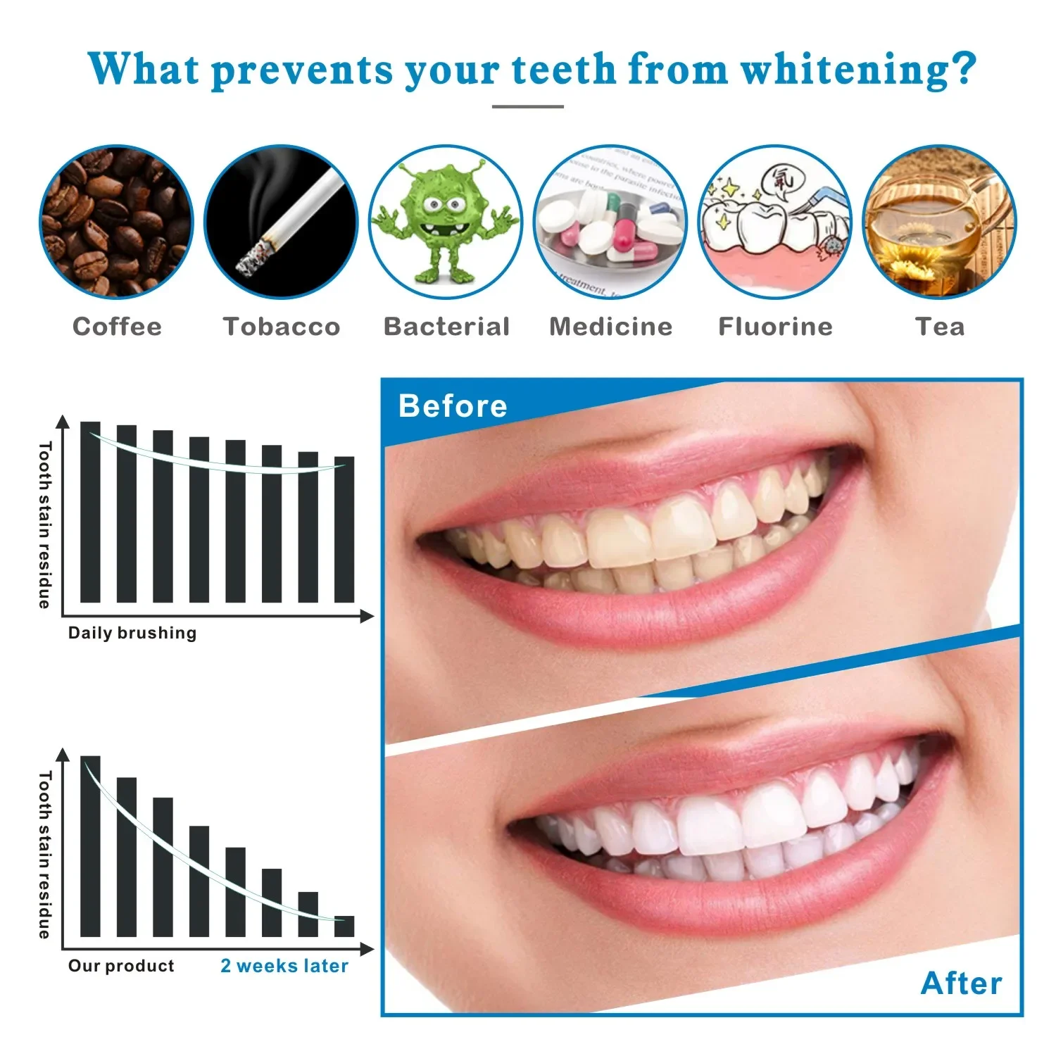14/28pcs 3D ฟันไวท์เทนนิ่งแถบ  - Teeth Whitening Effects บทวิจารณ์และราคา