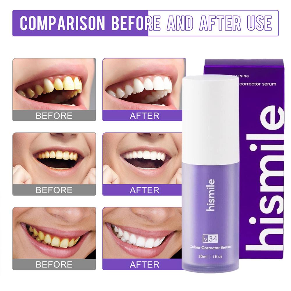 30 มล. ฮิสมายล์ V34 โฟมฟอกสีฟั - Teeth Whitening Crest บทวิจารณ์และราคา