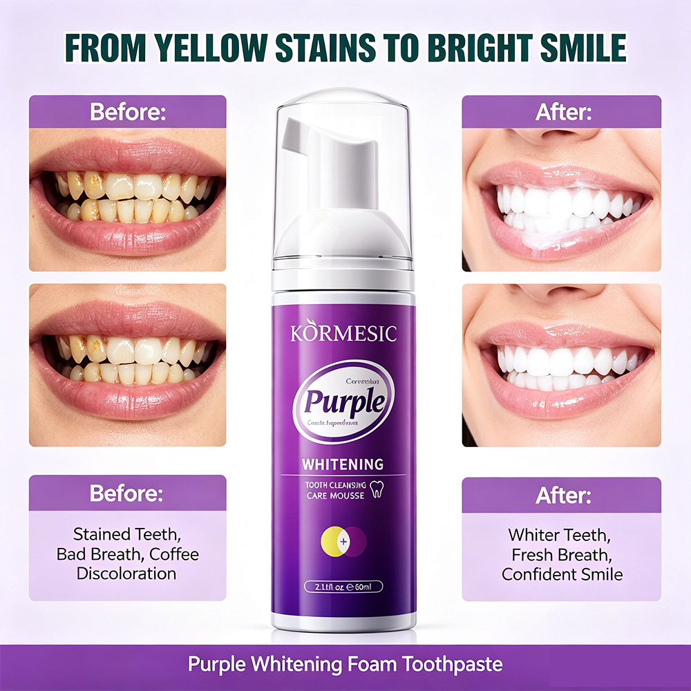 มูสฟอกฟันขาวสีม่วง V34 แก้ไขสี - Teeth Whitening Crest บทวิจารณ์และราคา